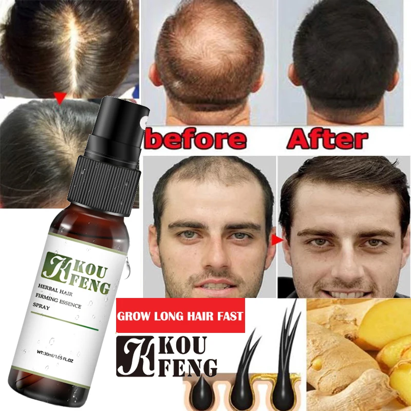 

KOUFENG Hair Growth Essential Oils Anti Hair Loss Serum Damaged Hair Repair Beauty Dense Hair Growth Hair Care Products