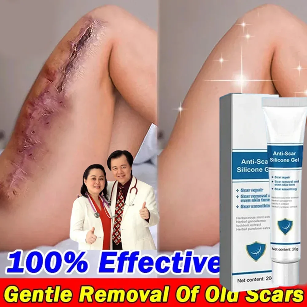 Восстанавливающий Крем Для рубцов быстрое удаление шрамов на коже лечение