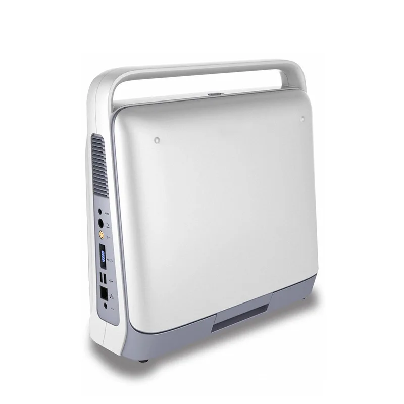 Рисунок 4 - Цветная допплеровская ультразвуковая