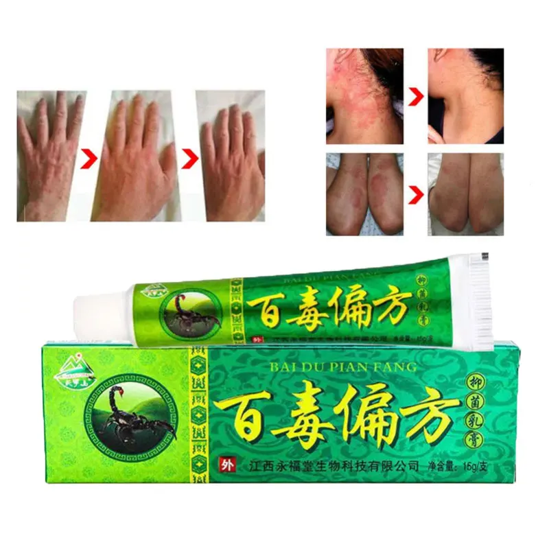 

Adults And Children Psoriasis Antibacterial Cream Dermatitis Eczematoid Ointment Chinese Herb Medical Skin Care 15g
