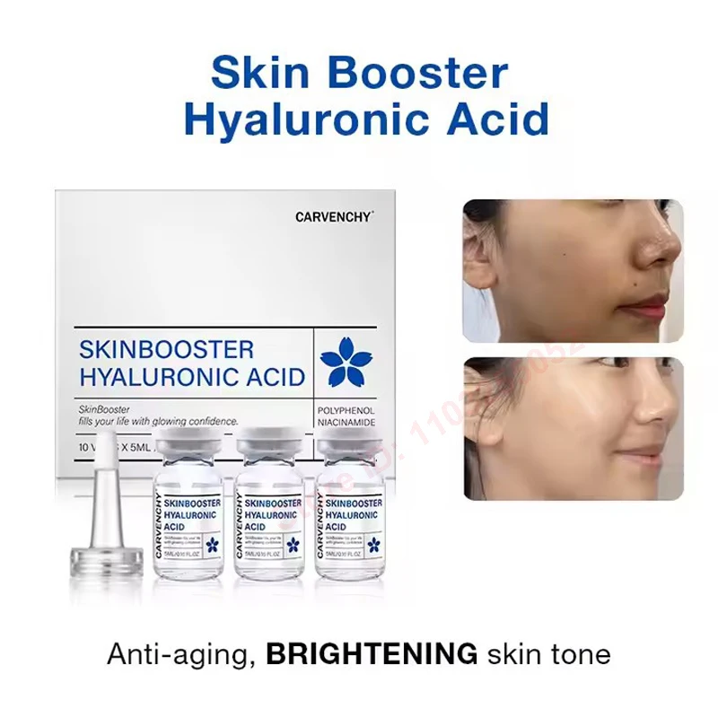Фото Набор из 5 флаконов Hyaluronic Acid SkinBooster с PDRN, ниацинамидом и глутатионом для увлажнения и ухода за кожей, подходит для салонов красоты №2