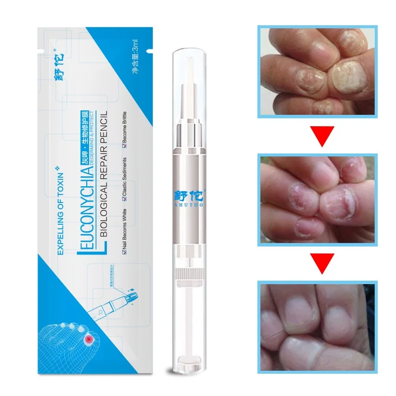 

3ML Liquid Anti Nail Toenail Fungus Nail Treatment Pen Cuticle Oil Pen Nails Care Solution Nail Treatments Tool Nail Care