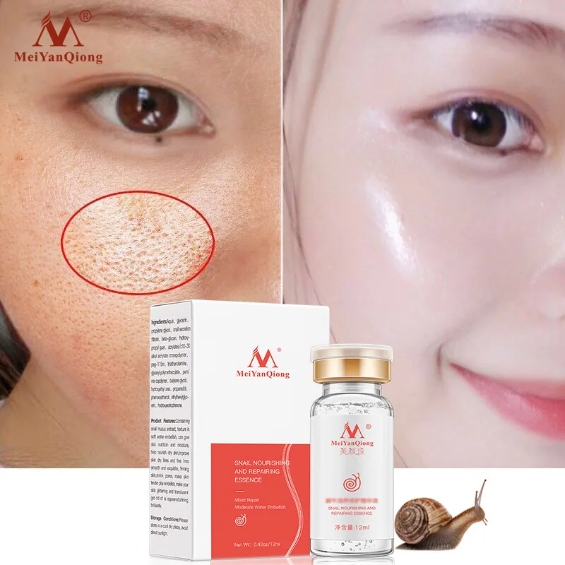 

Advanced Snail Collagen Anti-aging Essence Shrink Pores Whitening Spot Serum Hyaluronic Acid Anti-acne Regenerative Essence 10ml