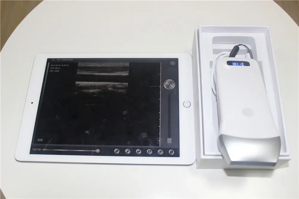 Популярный ручной медицинский беспроводной выпуклый зонд UProbe-3C ультразвуковой