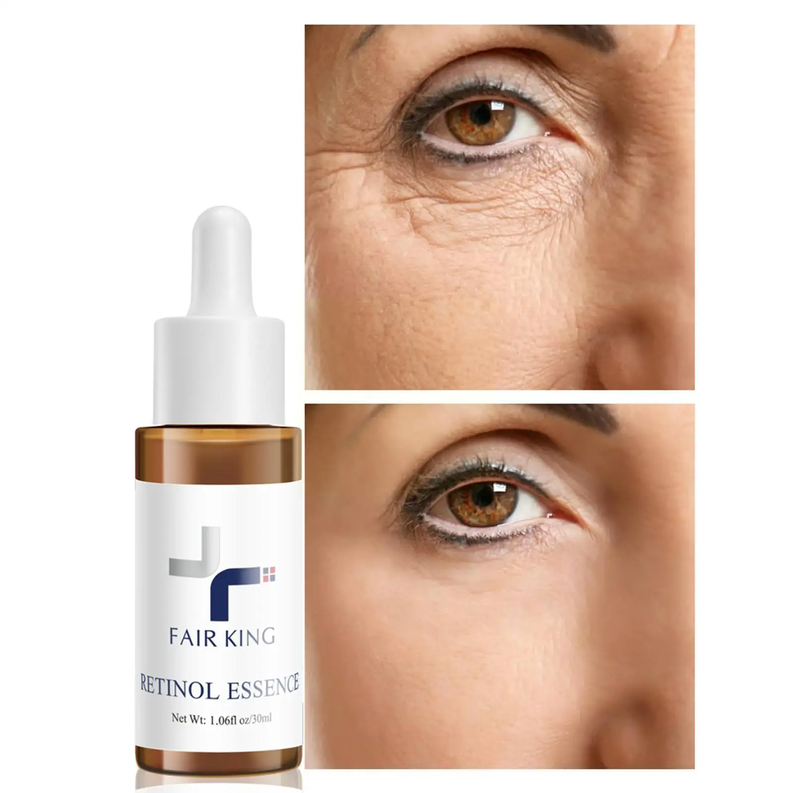 

Антивозрастная отбеливающая Сыворотка для лица, 30 мл, T9D9