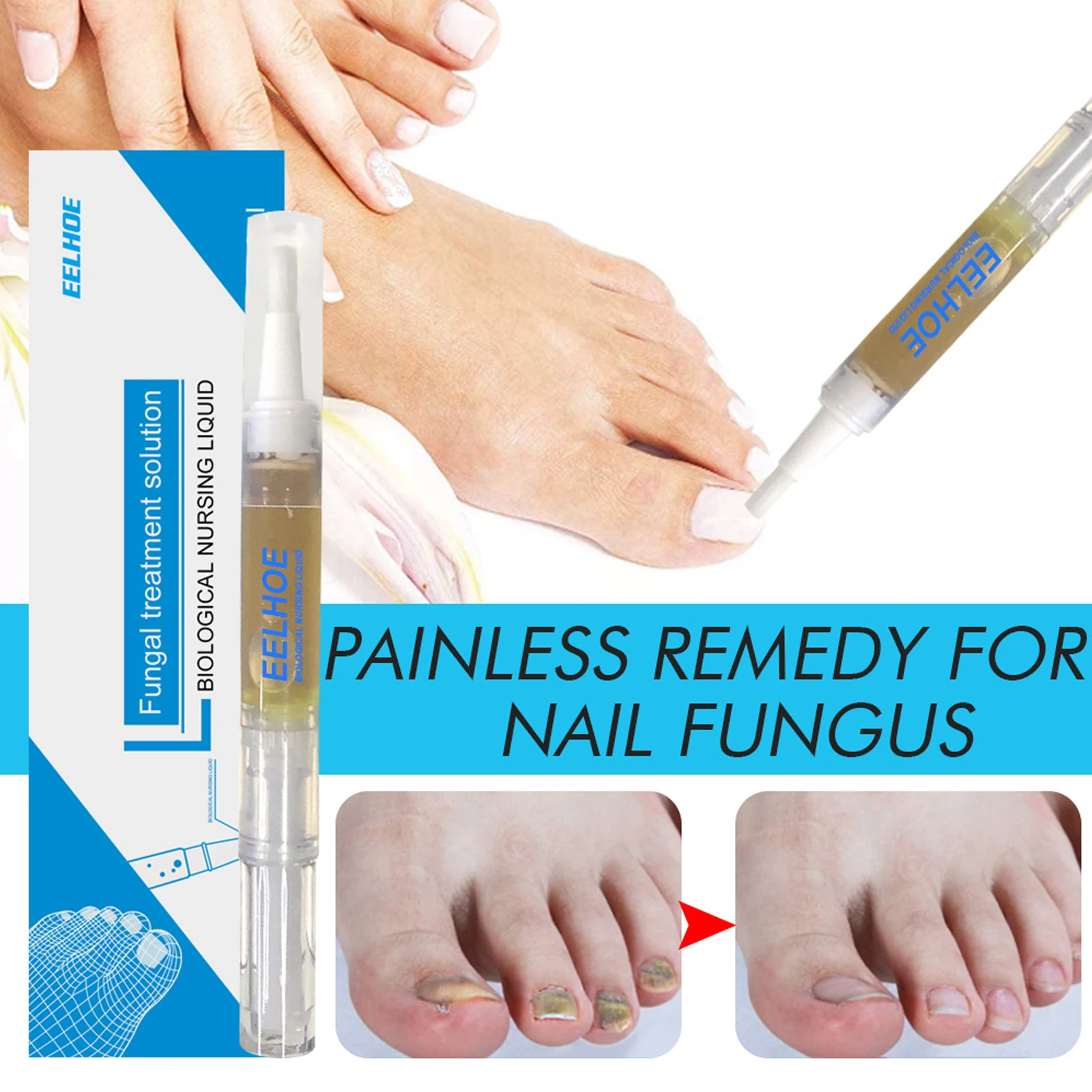 

3ML Nail Repair Liquid Toenail Fungus Nail Treatments Pen Nail Fungal Treatments Lasting Effect Feet Care Essences Nail Care