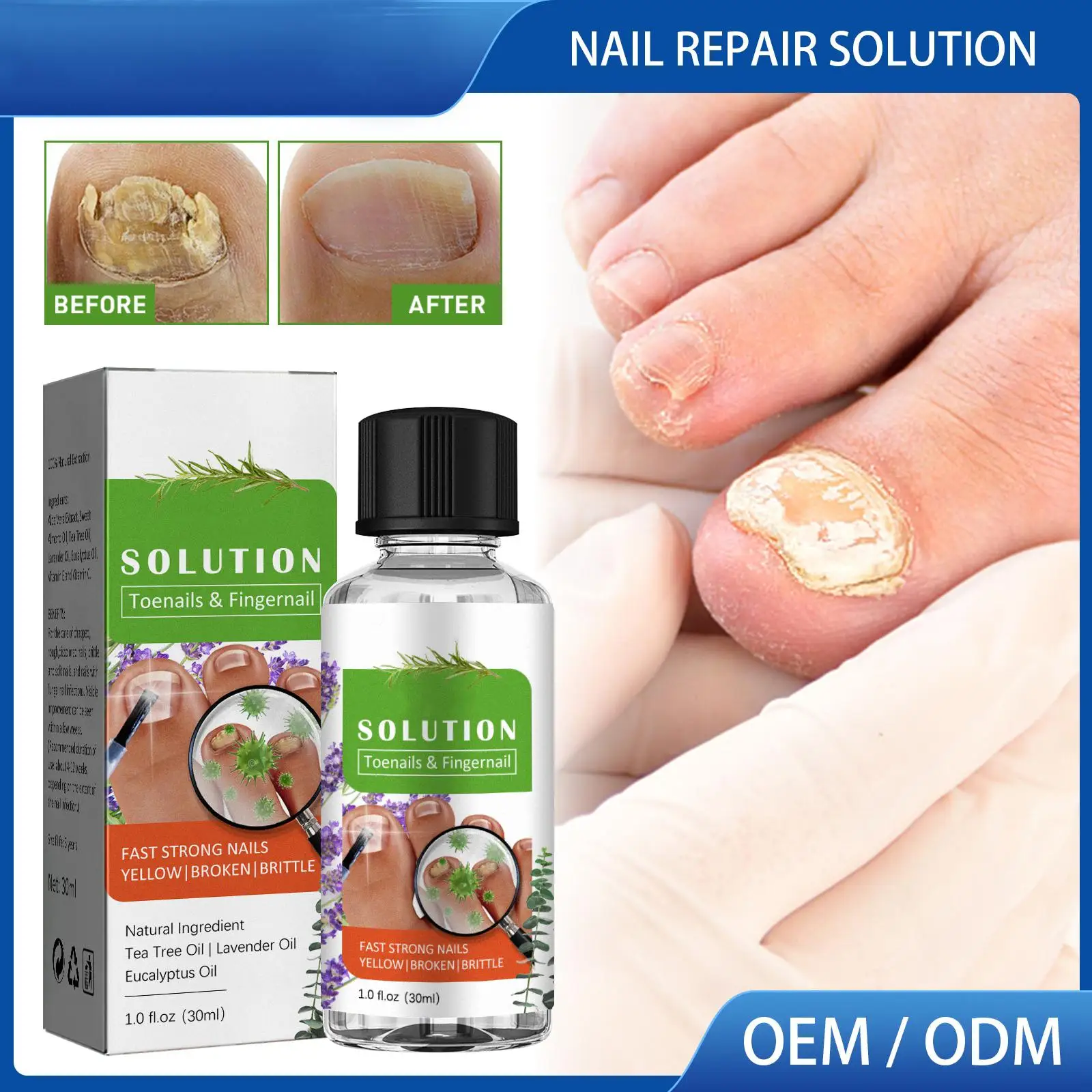 

Repairing Nail Solution 30ml for Broken Cracked and Split Nails
