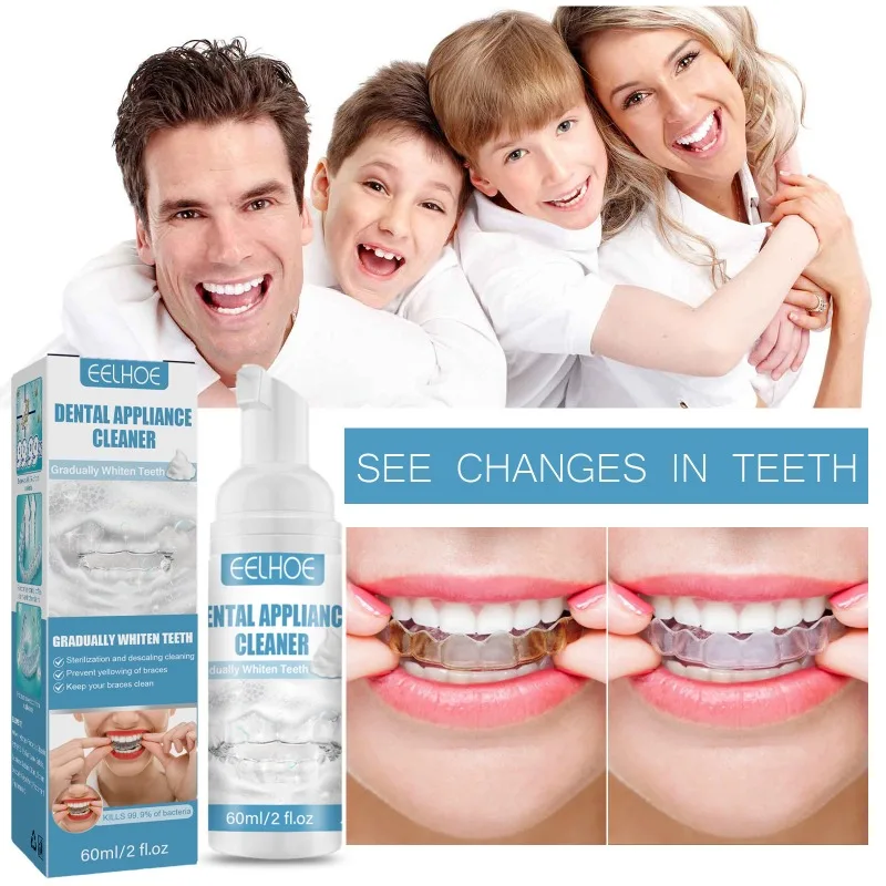 

60ML Denture Appliance Cleaner Orthodontic Foam Cleaner Braces Foam Cleaner Braces Stain Removal Oral Hygiene Dental Tool