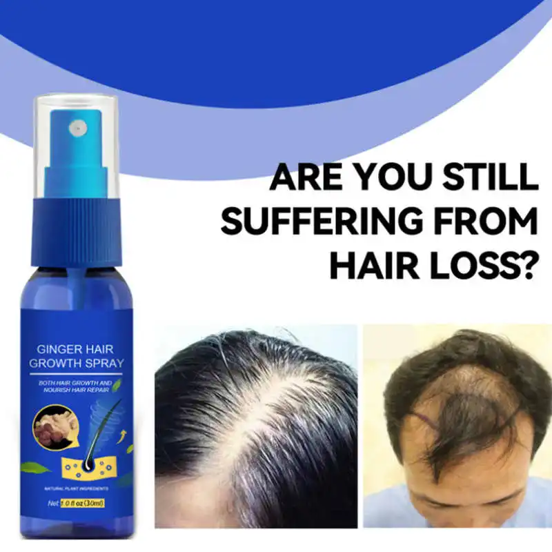 

30ml Fast Hair Growth Oil Ginger Serum Nourishing Soften Treatment Hair Loss Repair Damaged Hair Men Women Thinning Hair