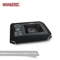 diagnostic portable digital ultrasound scanner