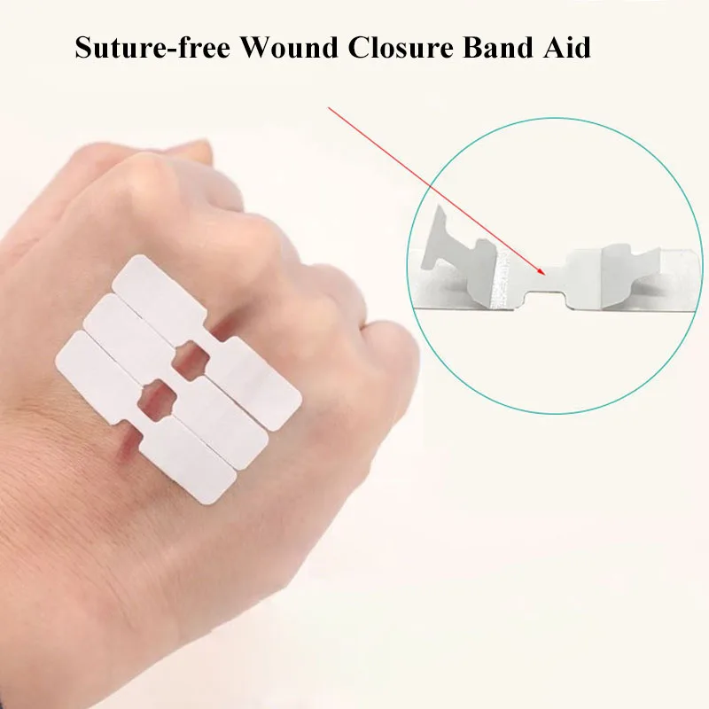 

50Pcs Butterfly Skin Wound Closure Strips Breathable Adhesive Free Suture Band Aid Emergency Wound Dressing Bandage