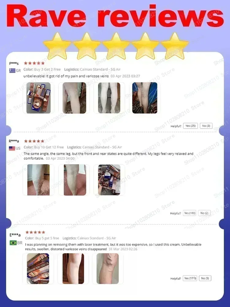 Крем для удаления варикозного расширения вен мазь ухода за телом крем лечения