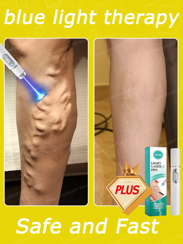 Крем Varicosse Blu-Ray pen