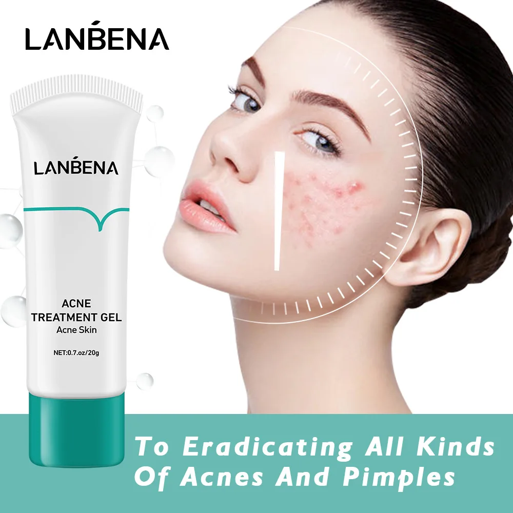 

LANBENA Acne Treatment Cream Face Clean Effective Fade Marks Scars Repair Damaged Skin Remove Blackheads Pimples Gel Oil Control