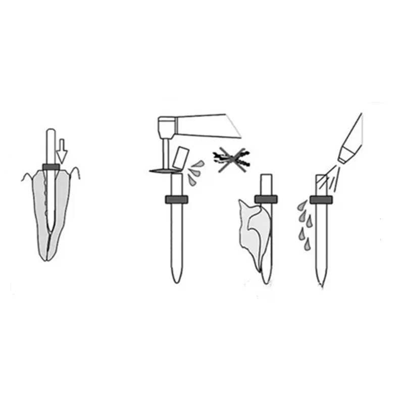 

3M ESPE Straight / 3D Screw Dental Disposable Fiber Paper Root Canal Therapeutic Material