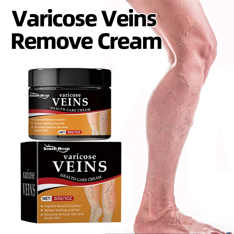 Крем для лечения варикозного расширения вен восстанавливает боль в ногах