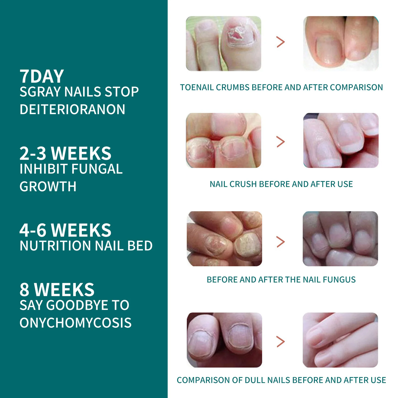 Рисунок 4 - Жидкий противогрибок для ногтей