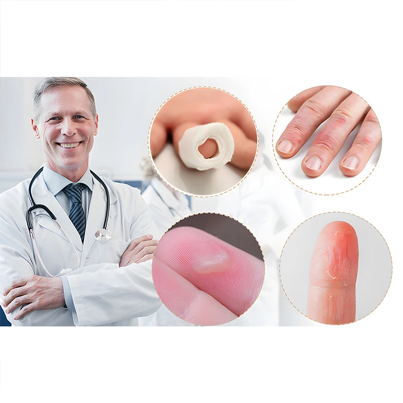 10 шт. силиконовая защита для пальцев мягкие дышащие гелевые напальчники