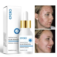 effective acne treatment face serum remove pimples fade acne scar essence shrink pores oil control moisturizing whitening skin