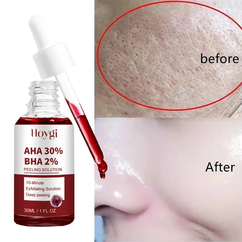 Сыворотка для сужения пор пилинг лица удаление больших подтяжка восстановление