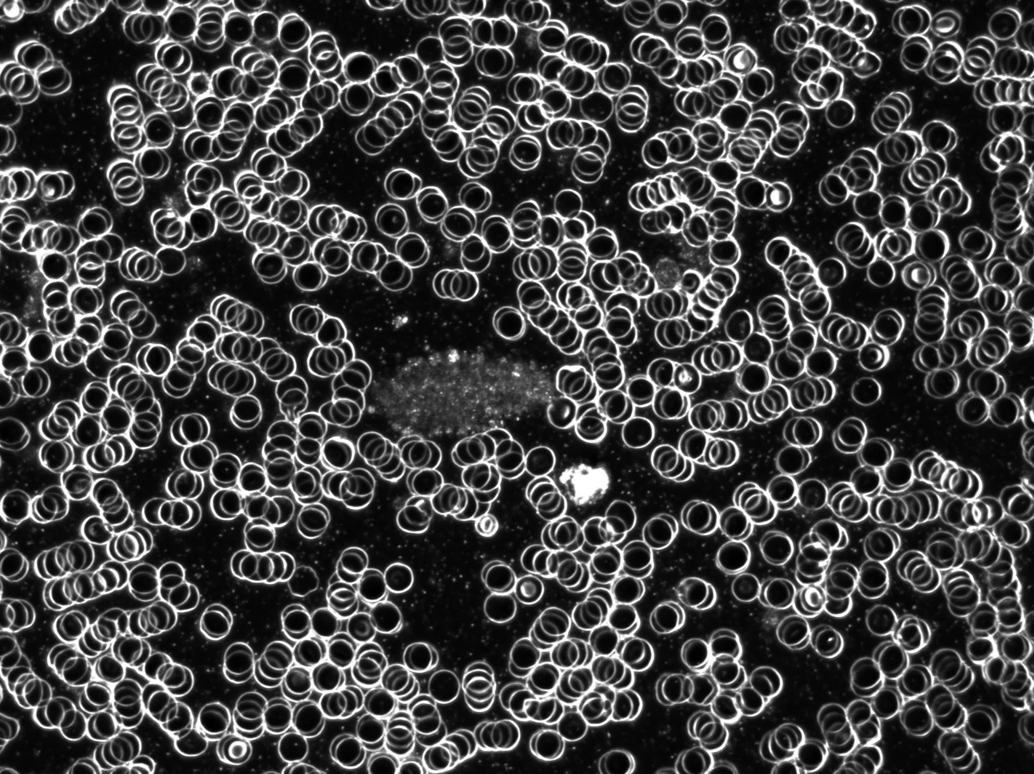 BestScope BS-2041T(DF) 4X 10X 40X 100X объективный тринокулярный биологический микроскоп темного