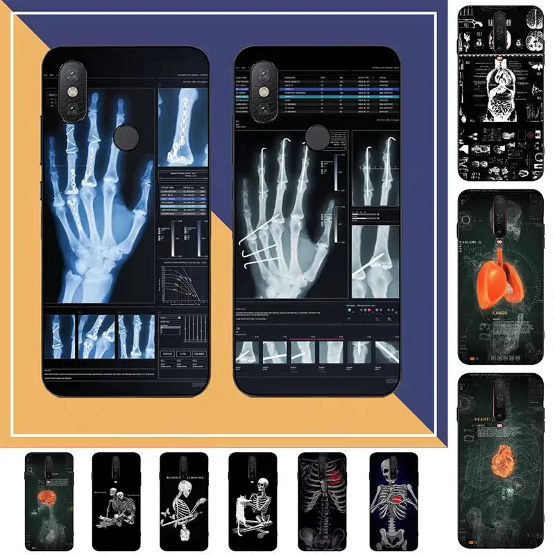 

Radiological human organs Skeleton skull Phone Case for Redmi Note 8 7 9 4 6 pro max T X 5A 3 10 lite pro