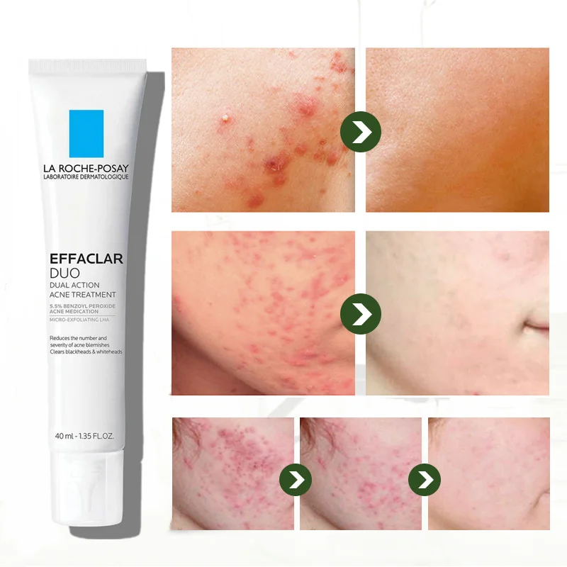 

La Roche Posay EFFACLAR DUO + средство для лечения акне, средство для удаления следов акне, мощное средство для удаления черных точек с кожей, 40 мл