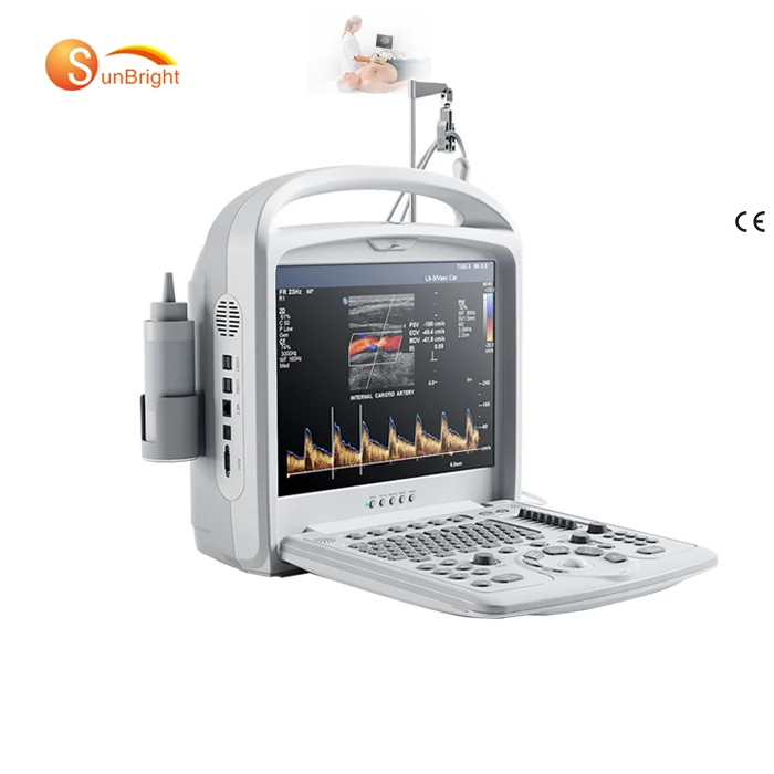 

Sunbright ultrasound ecografo portatil en color doppler de 3d / escaner portable en color