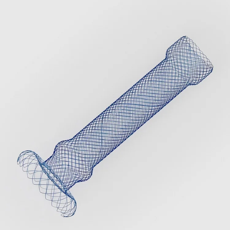 

Ni-ti wire Fistula-occluding metallic uncovered cardia umbrella esophageal stent