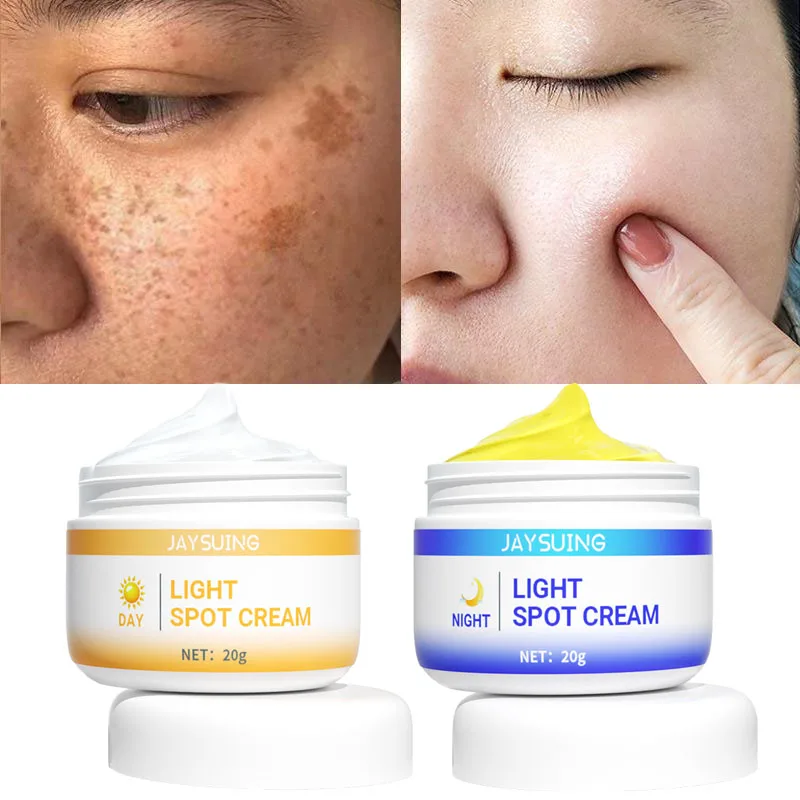 

Whitening Freckles Cream Remove Dark Spots Melasma Fade Acne Scars Anti Aging Nourish Brighten Day Night Skin Care Products 2PCS