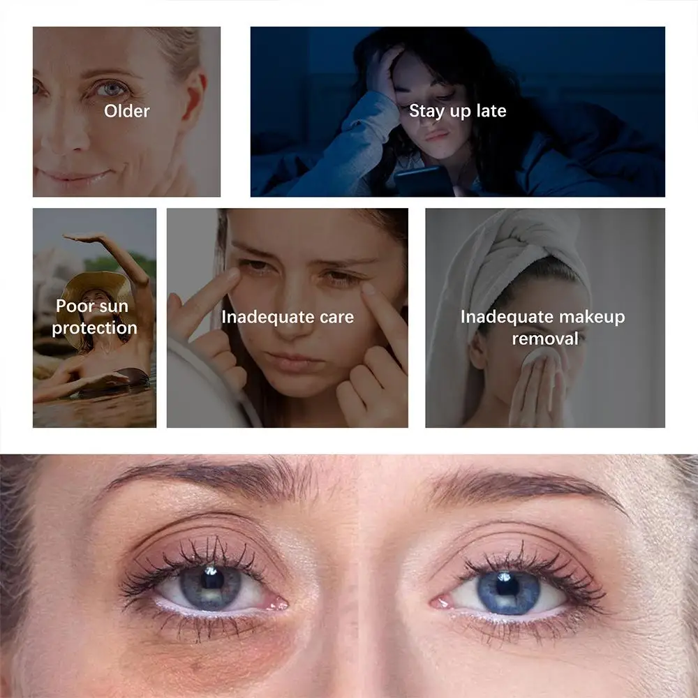 Рисунок 5 - антивозрастной крем для области вокруг глаз