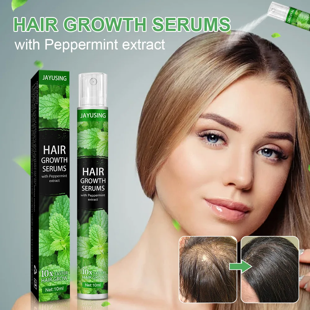 

4/1pcs Herbal Essence Hair Growth Spray Serum Anti Hair Loss Products Fast Grow Prevent Hair Dry Damaged Thinning Repair Care