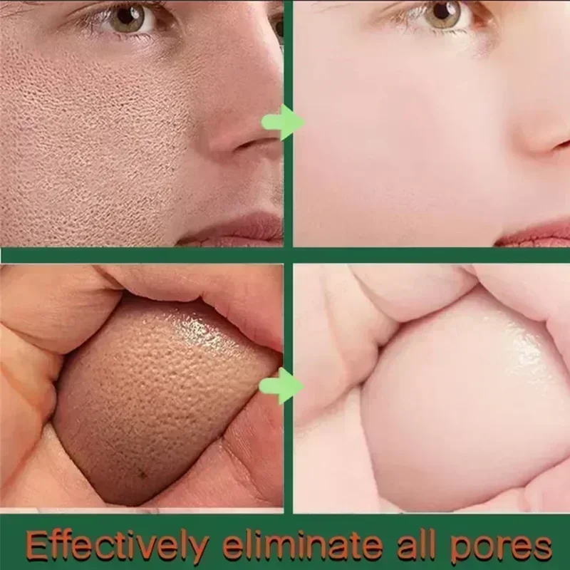 Горячая распродажа Текстура кожи | Осветляющая сыворотка для лица очищения пор с