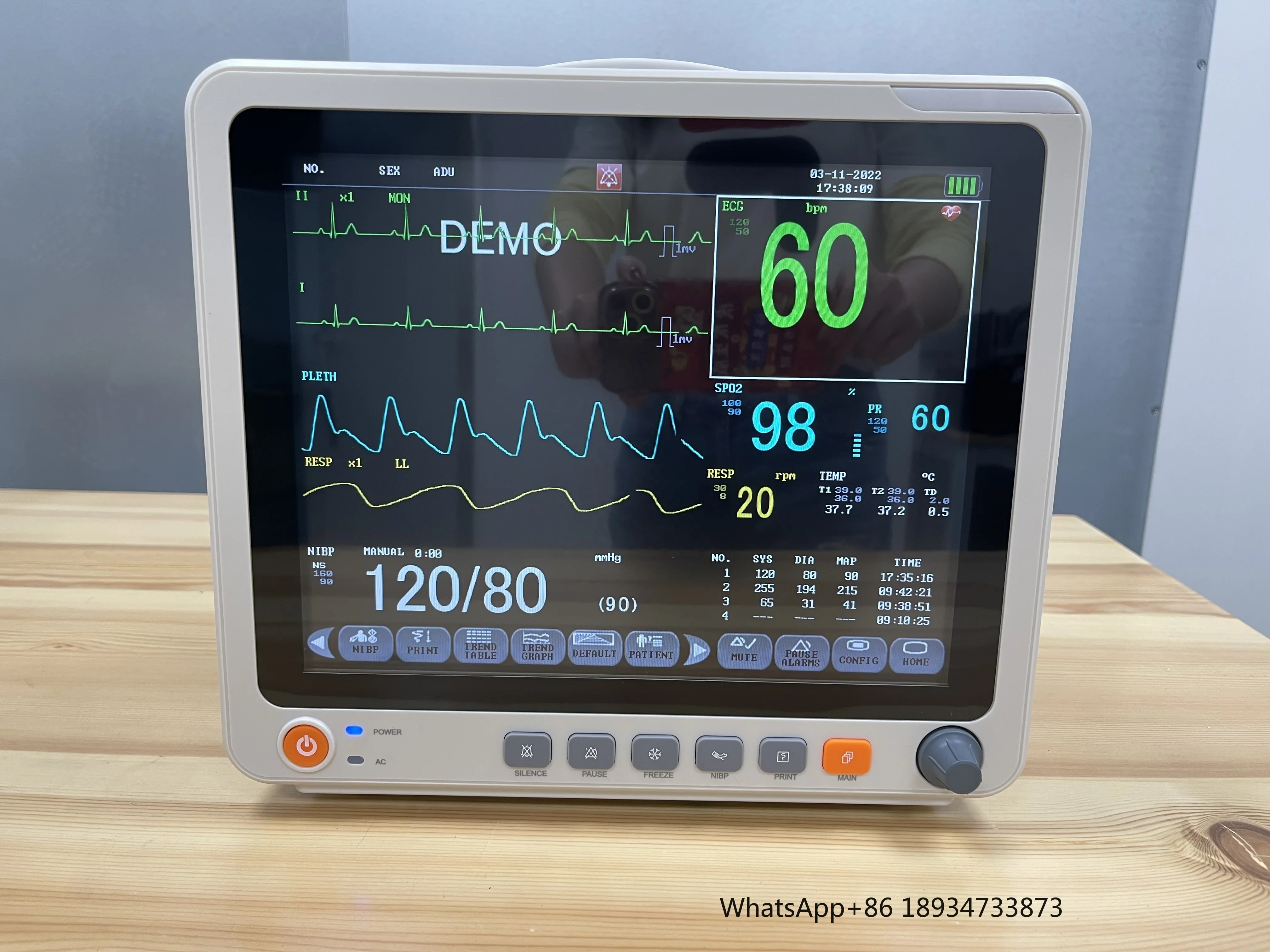 Портативные ветеринарные медицинские цифровые многопараметры с NIBP TEMP SPO2 RESP и PR |