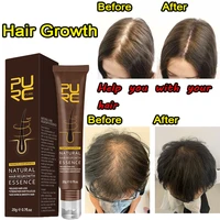 hot sale fast hair growth oil thickener essence anti hairs loss care scalp massage roller treatments fast grow hair oil products