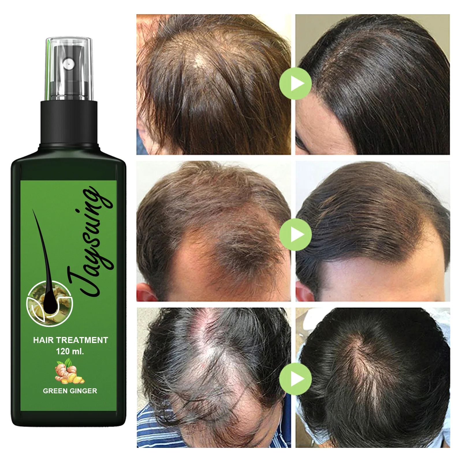 

30ml Hair Fast Growth And Hair Care Essential Oil Natural Ginger Hair Regrowth Products Serum Hair Care Hair Loss Series