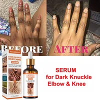 dark kunckle whitening serum strong whitening serum for dark knuckle fingel for removing dark knuckle elbow and knee 50ml