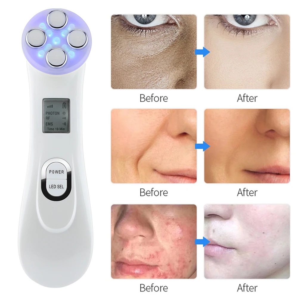 

Facial RF Importer EMS Micro Current Radio Frequency Color Light Skin Rejuvenation IPL Lift Firming Anti-aging Wrinkle Acne