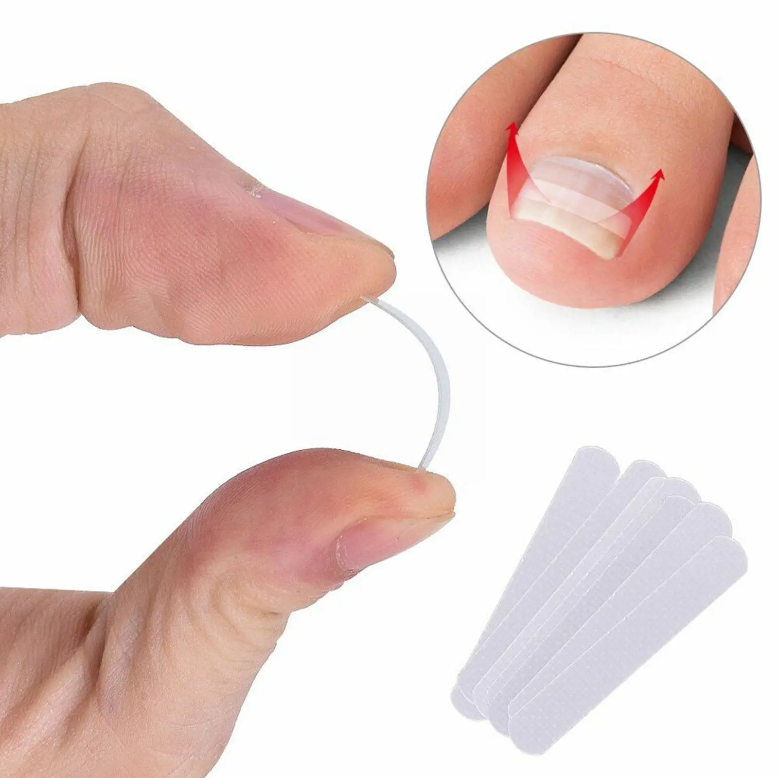 

10 шт./компл. выпрямитель для вросших ног клипса для коррекции эластичных ногтей изогнутая зажим-скобка выпрямитель Наклейка для выпрямления эластичные ногти H2o0