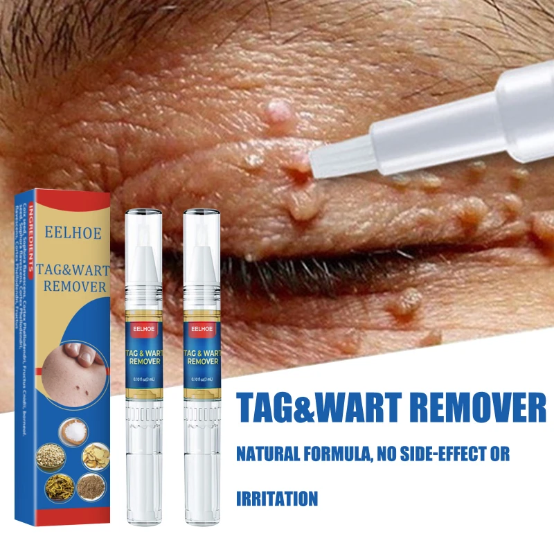 

Skin Tag Remover Medical Against Moles Painless Fast Removal Genital Wart Acne Spot Treatment Papillomas Flat Wart Skin Care