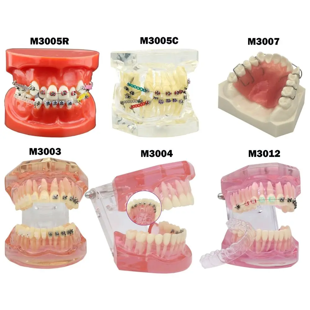 

Dental Orthodontic Teeth Model with Metal Ceramic Brackets Lingual Braces Tube