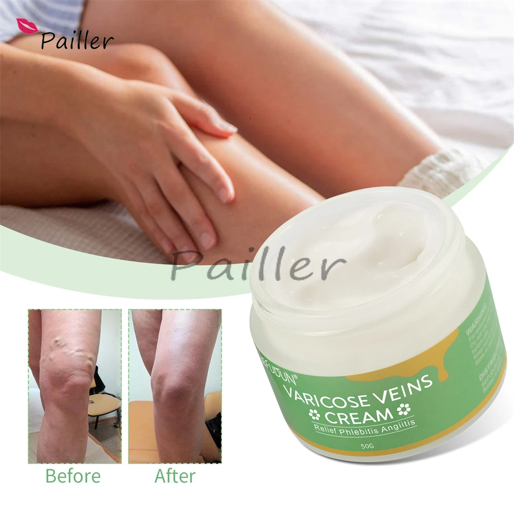 

Успокаивающий Крем для ног от варикозного расширения вен, 50 г