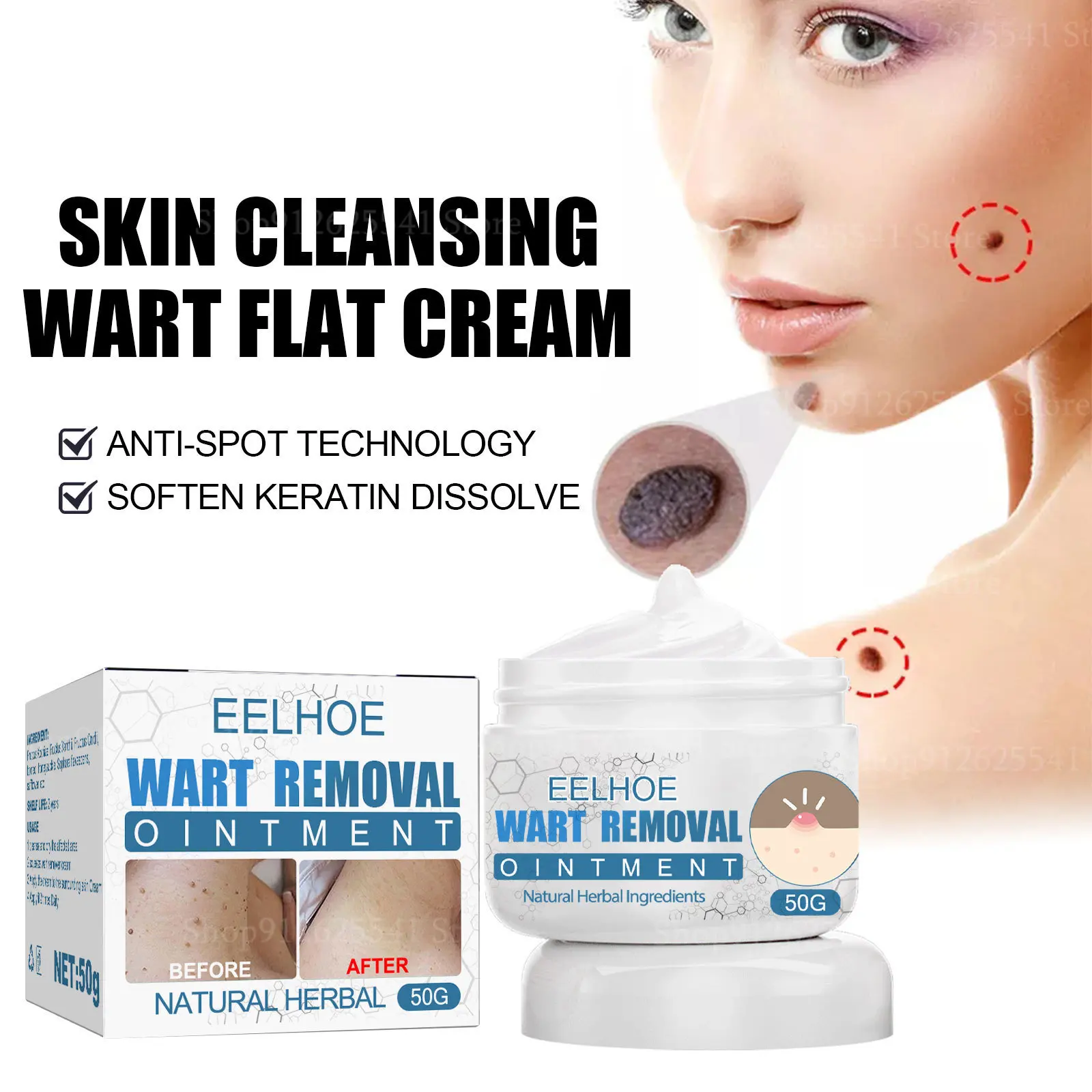 

50g Safe Body Warts Acne Treatment Painless Skin Tag Warts Removal Cream Neck Armpit Flat Warts Moles Remover Ointment Body Care