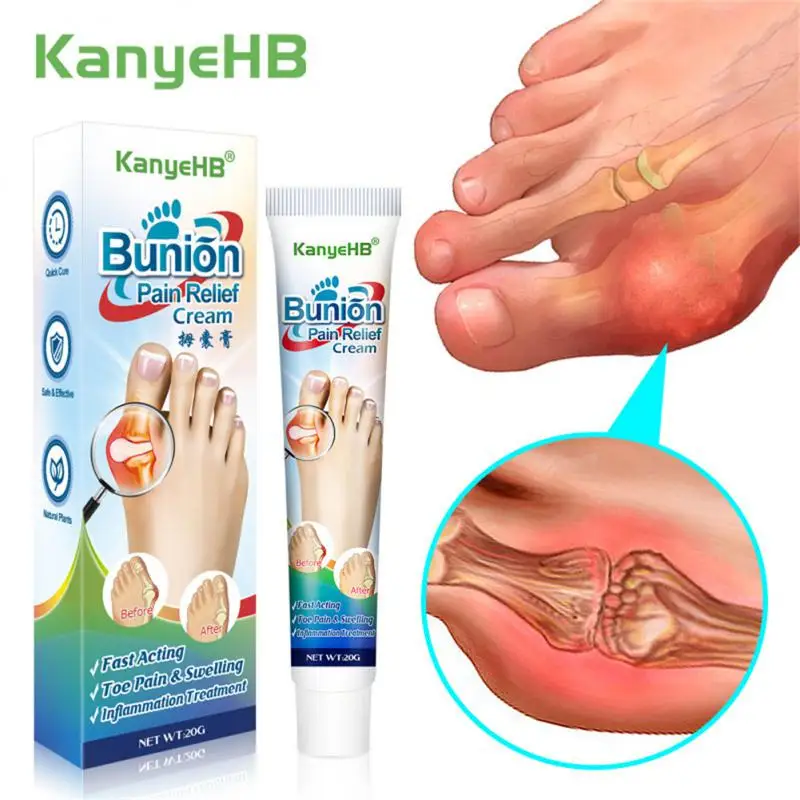 

Thumb Corrector Quick Pain Relief Deformities Numbness Of Limbs Toe Swelling Skin Care Foot Gout 20g Bunion Cream Safe