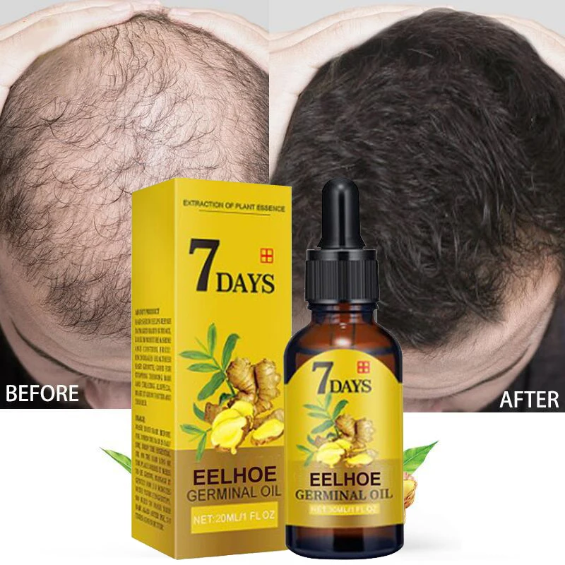 

Имбирное эфирное масло для роста волос, быстрорастущее эфирное масло, натуральное средство против выпадения волос в течение 7 дней, масло для роста волос и бороды для мужчин