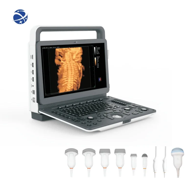 Портативный 2d 3d 4d эхокардиографический портативный цветной допплер-сканер для