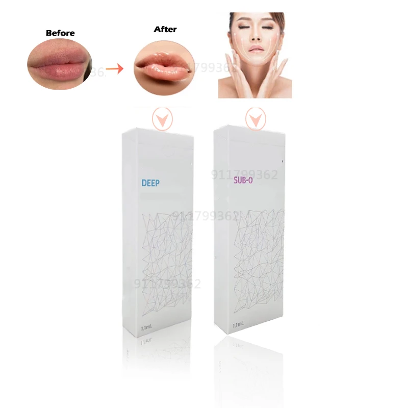 

1.1ml Lip Hyaluronic Acid BB Cream Moisturizing BB Lip Cream Essence