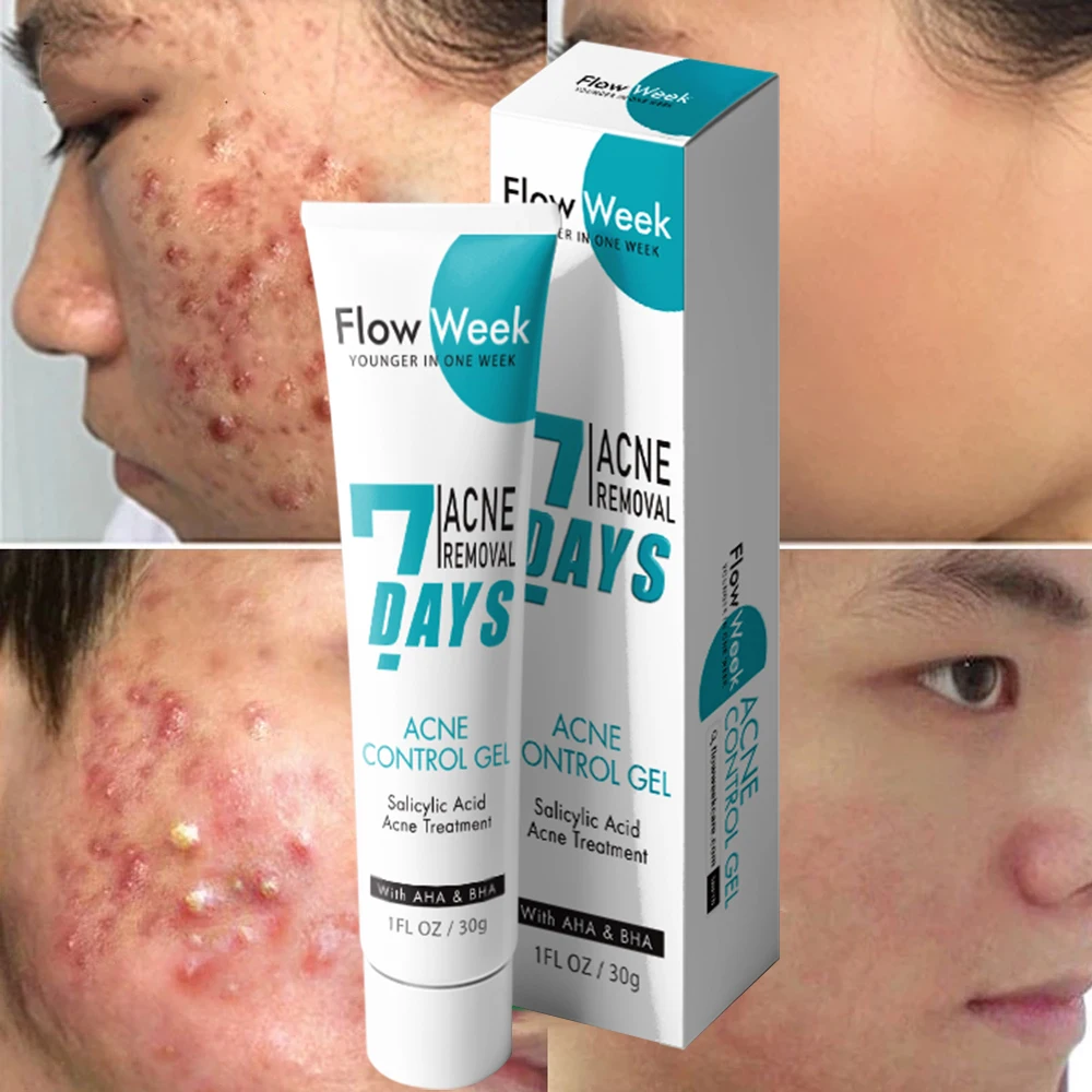 

FlowWeek Herbal Acne Removal Face Gel Effective Treatment Acne Scar Spots Gel Control Shrink Pores Moisturizing Anti-Acne Gel