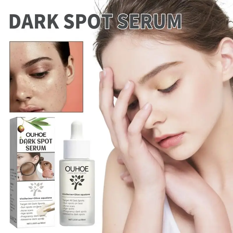 Face Serum Dark Spot Acne Lightening Spot Moisturizing Skin Serum Repair Acne Printed Brightening Skin Tone Serum Face Care
