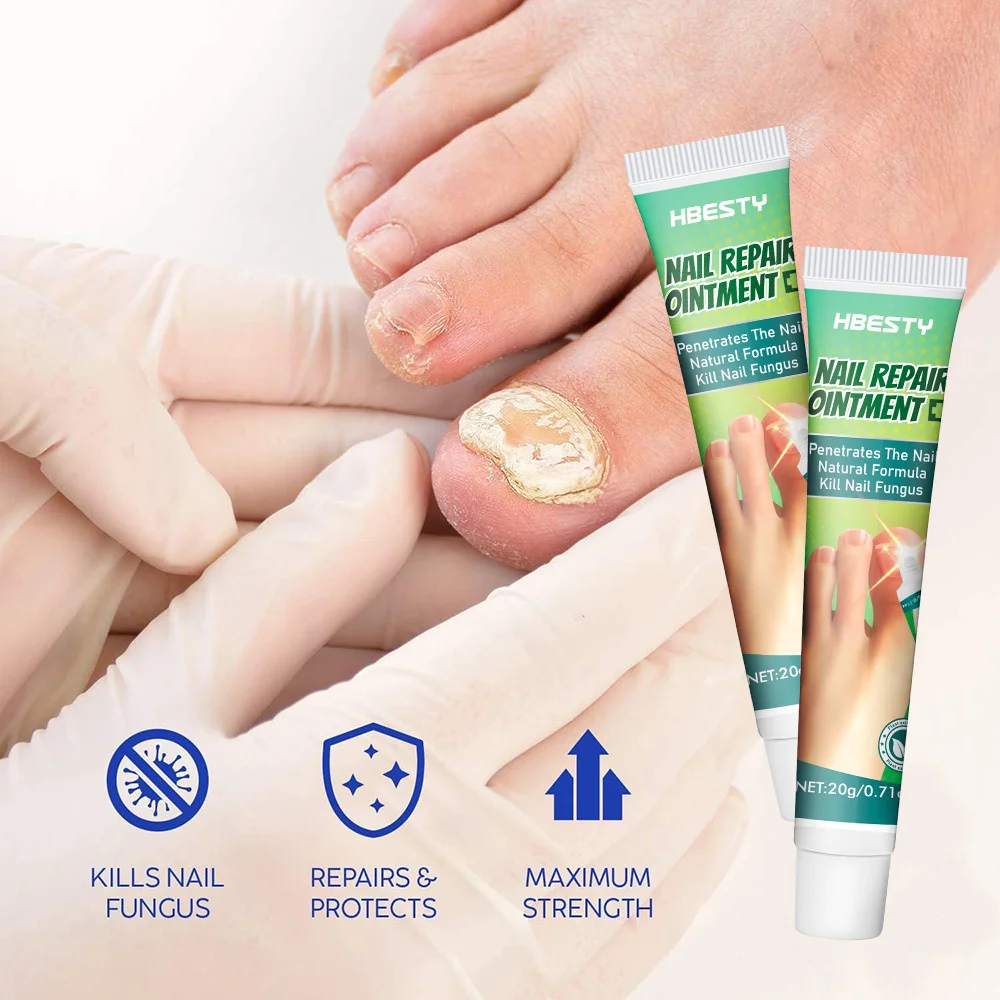 

Средство для удаления грибка ногтей успокаивающий Натуральный Питательный Уход за ногтями лучший средство для удаления грибка ногтей ремонт педикюра эффективный умеренный